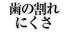 歯の割れにくさ